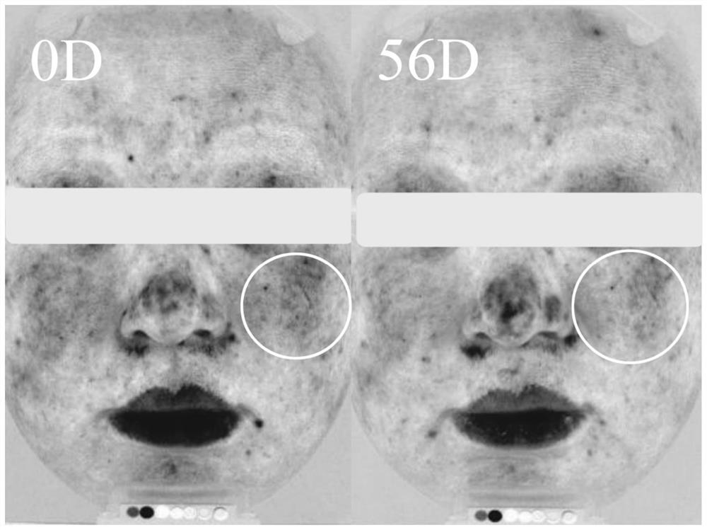 Anti-inflammatory water-in-oil-in-water emulsion and application thereof