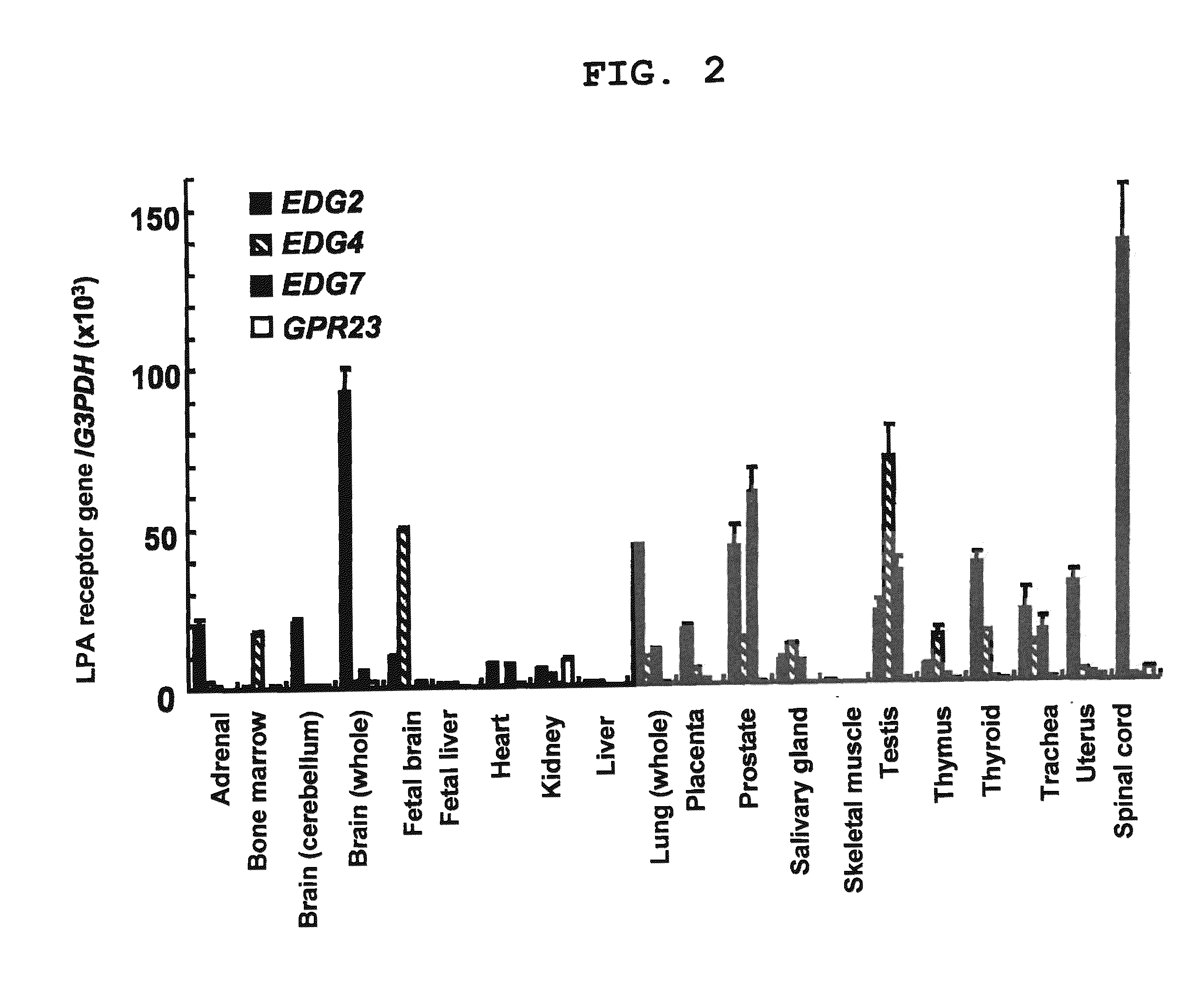 Gene sensitive to bone/joint disease and use thereof