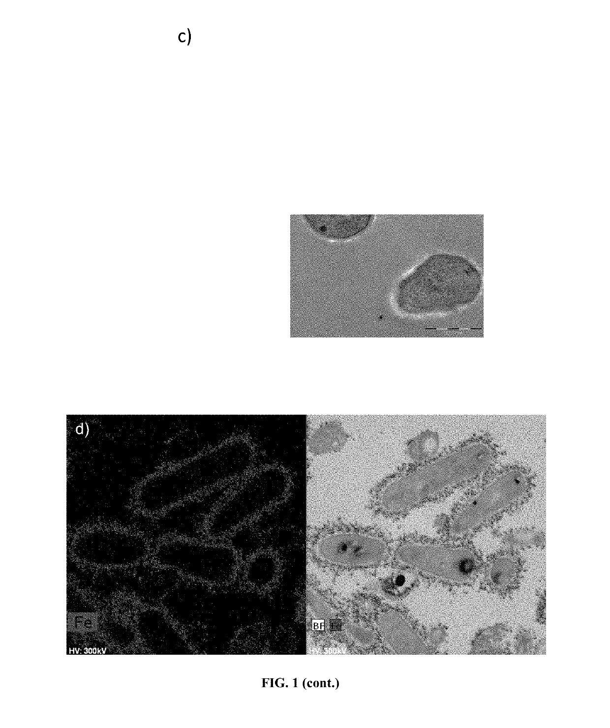 Probiotic bacteria comprising metals, metal nanoparticles and uses thereof