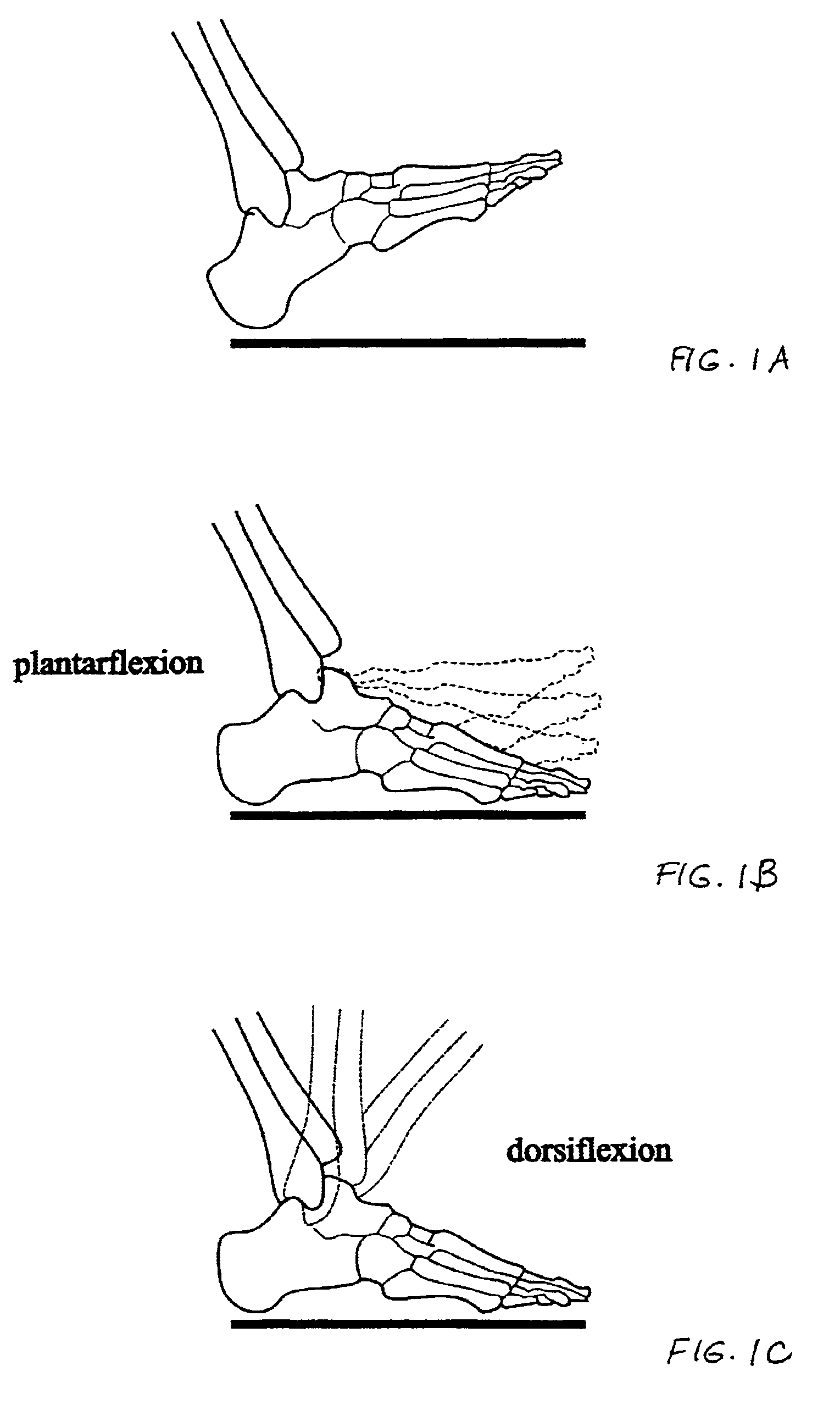 Footwear with impact absorbing system