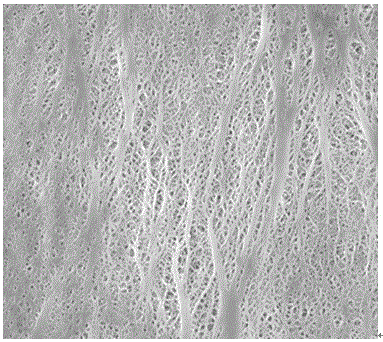 Pressureproof three-layer composite structured polypropylene microporous membrane