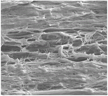 Pressureproof three-layer composite structured polypropylene microporous membrane