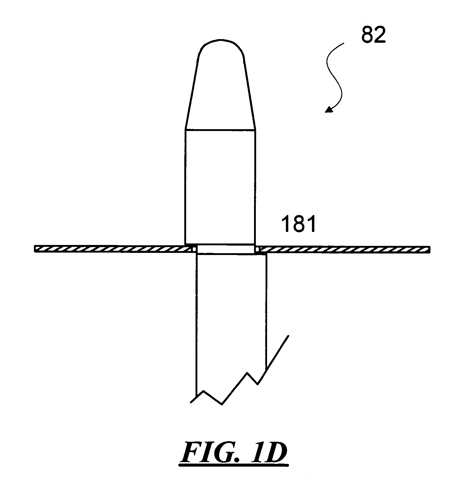 Integrated disc inspection and repair apparatus and appertaining method