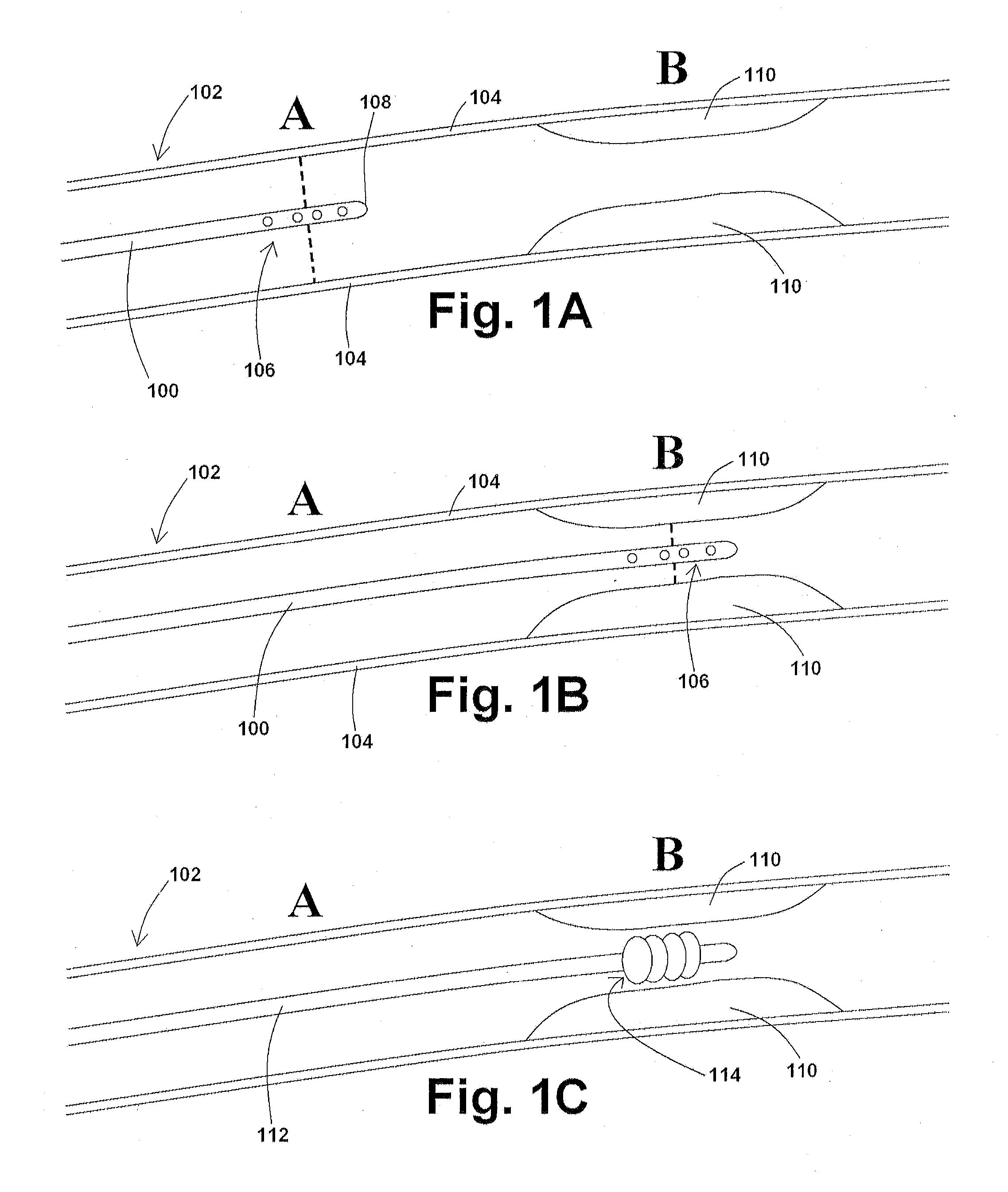 Devices, systems, and methods for removing targeted lesions from vessels