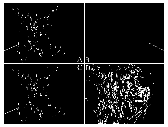 A method for simultaneous detection of cancer-associated fibroblasts and expressed proteins thereof