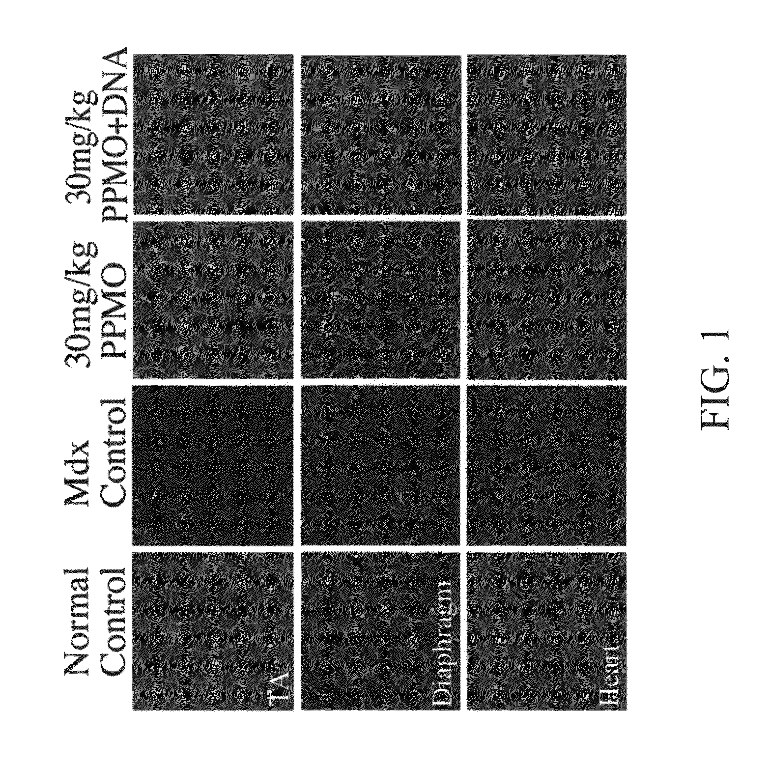 Pharmaceutical compositions comprising antisense oligonucleotides and methods of using same