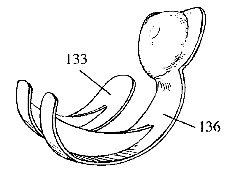 Bicompartmental Implants and Method of Use