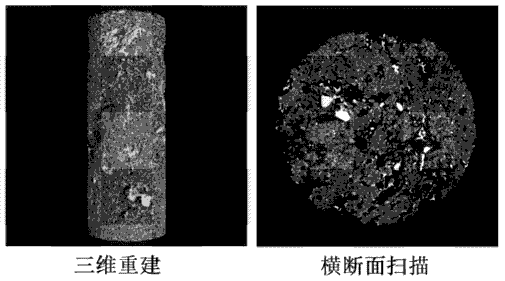 An injectable-porous-drug-loaded polymethyl methacrylate-based composite scaffold bone graft material and its preparation method
