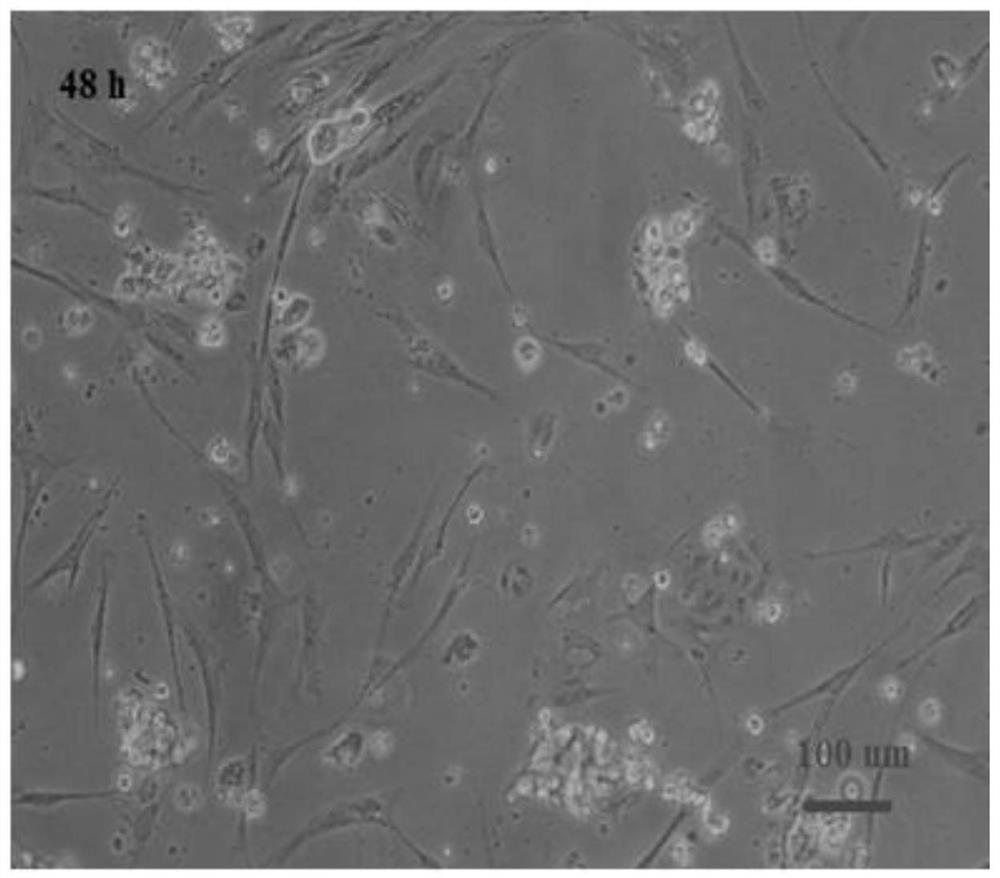 Isolation and culture method of primary hepatocytes of bream