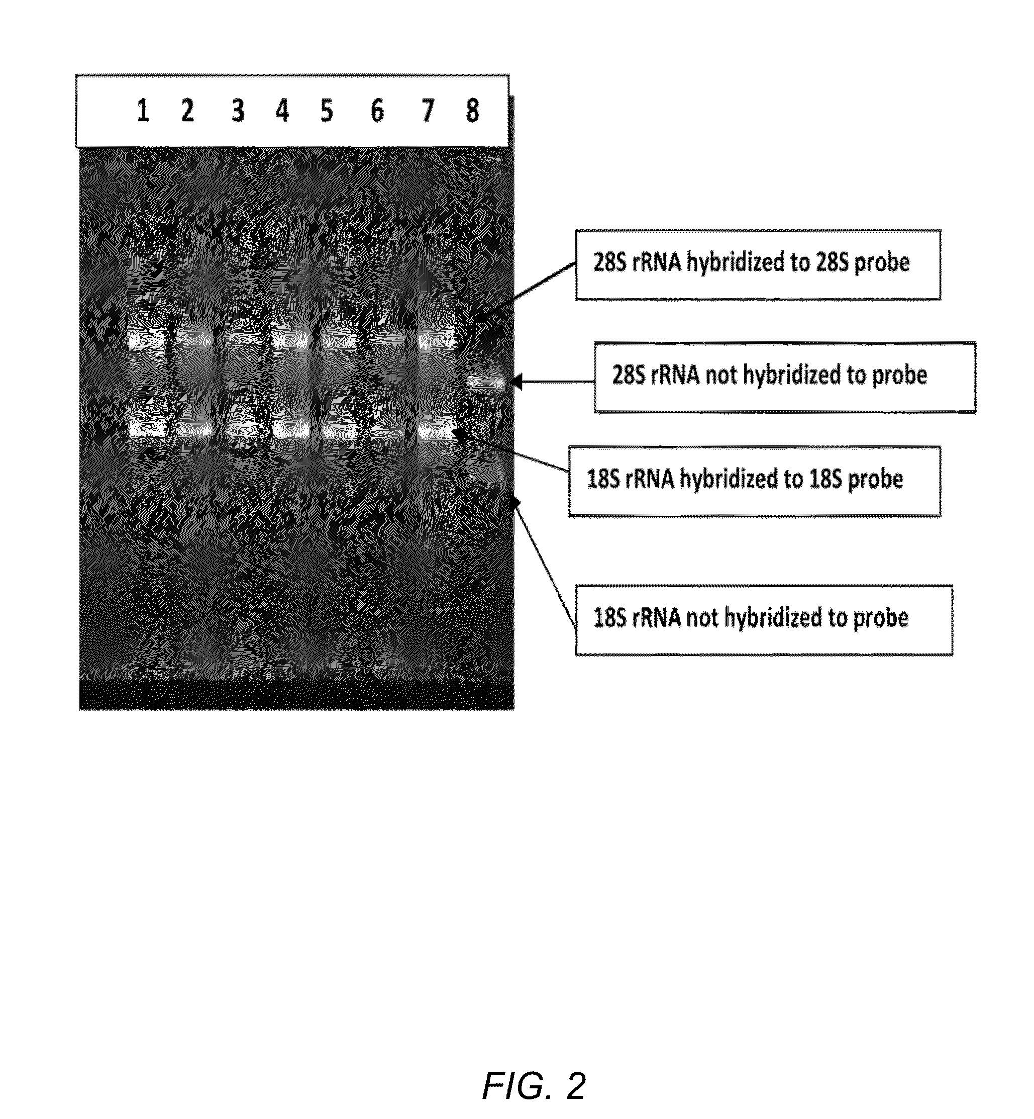 Methods and compositions for improving removal of ribosomal RNA from biological samples