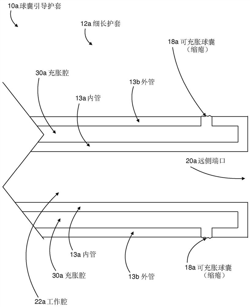 Internal carotid artery thrombectomy devices and methods