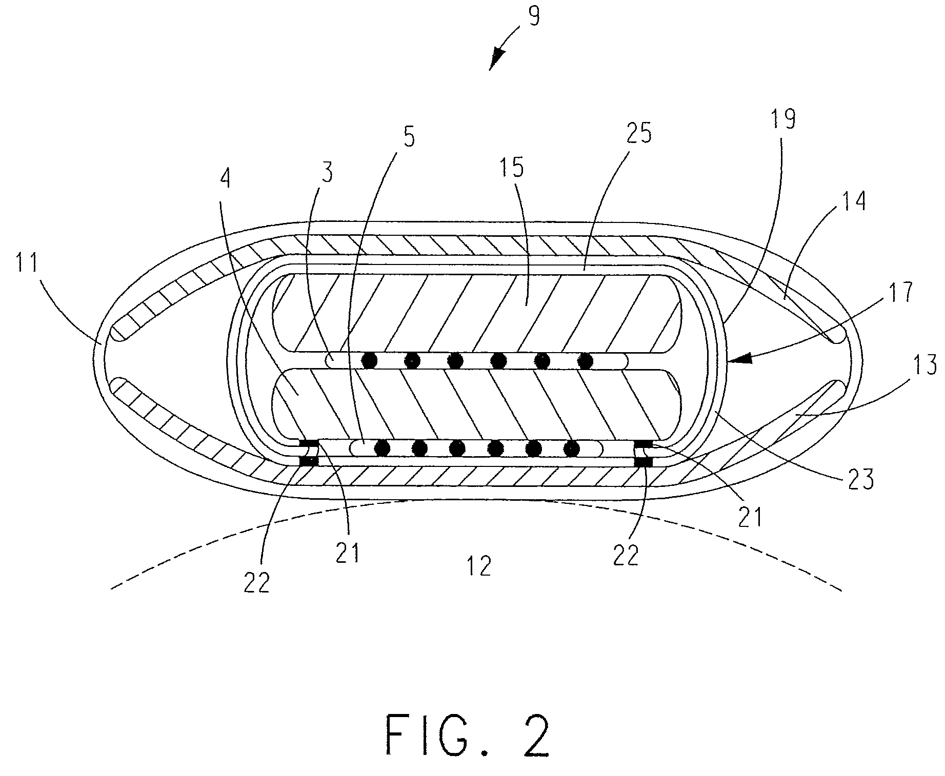 Shielded diathermy applicator with automatic tuning and low incidental radiation