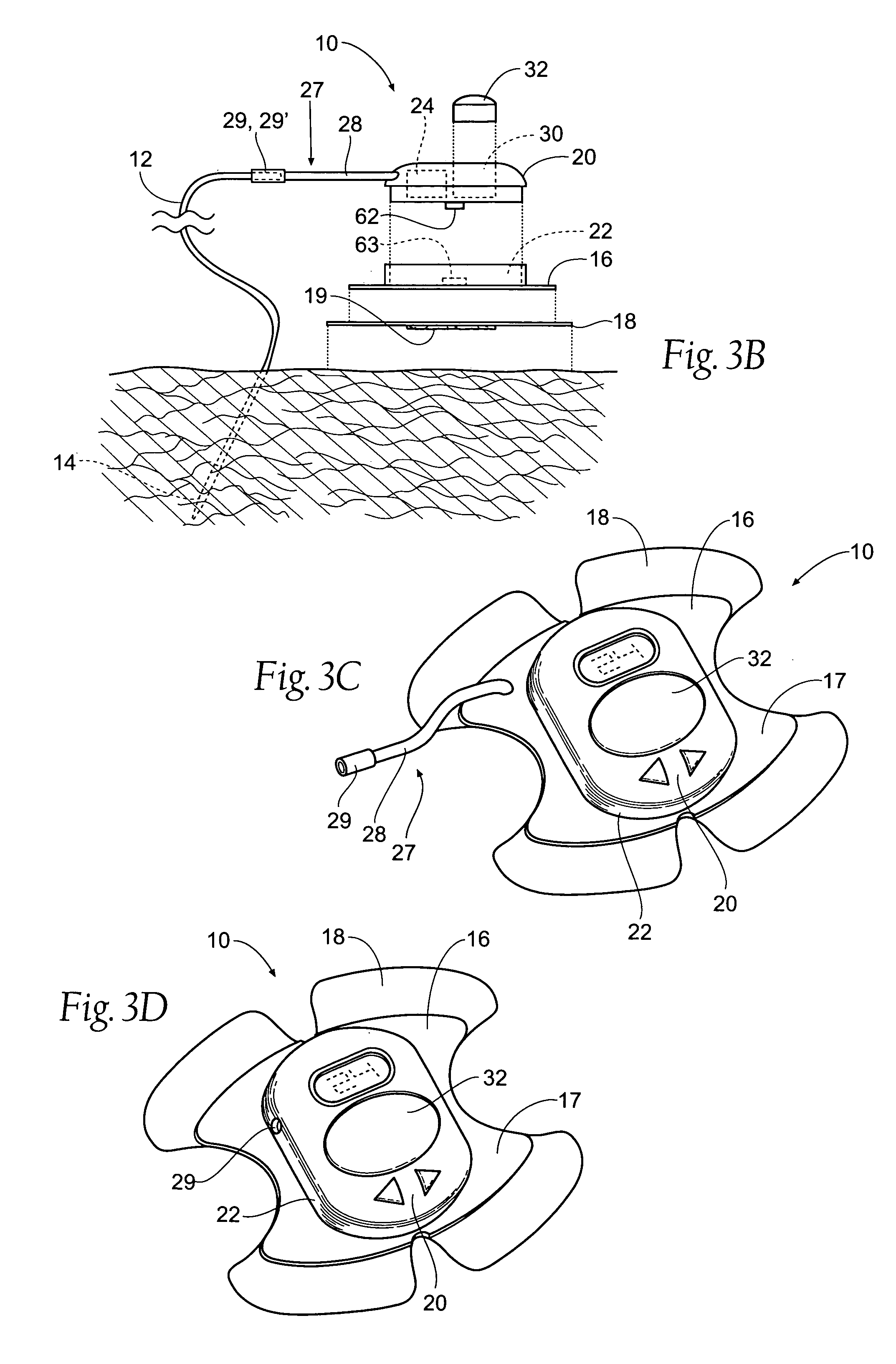 Portable assemblies, systems, and methods for providing functional or therapeutic neurostimulation