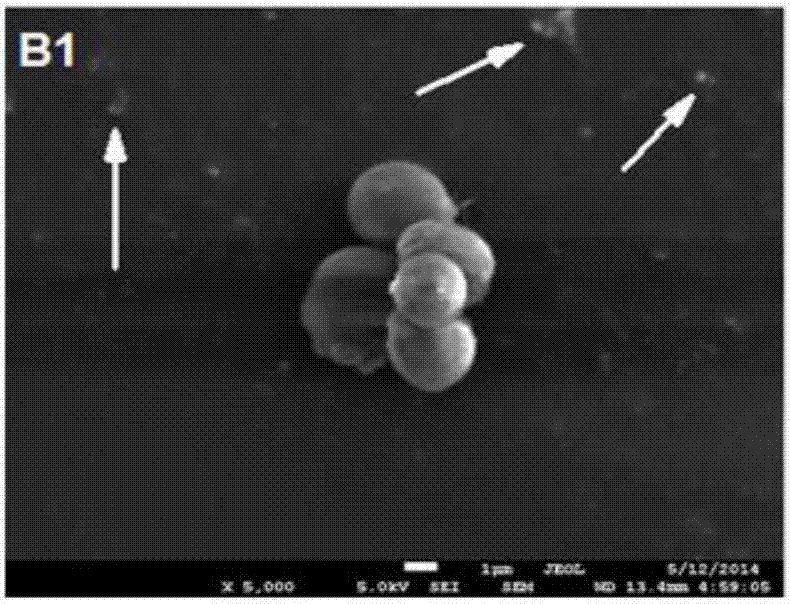 Quick preparation method for candida albicans specimen for field emission scanning electron microscope