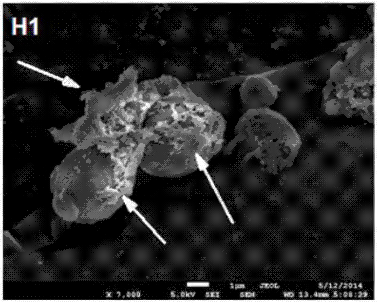 Quick preparation method for candida albicans specimen for field emission scanning electron microscope