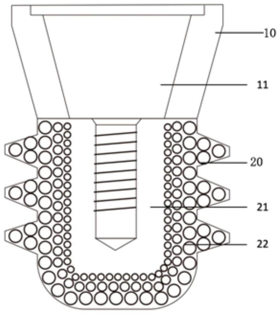 3D-printed short implant with gradient and porous outer layer and preparation method for 3D-printed short implant