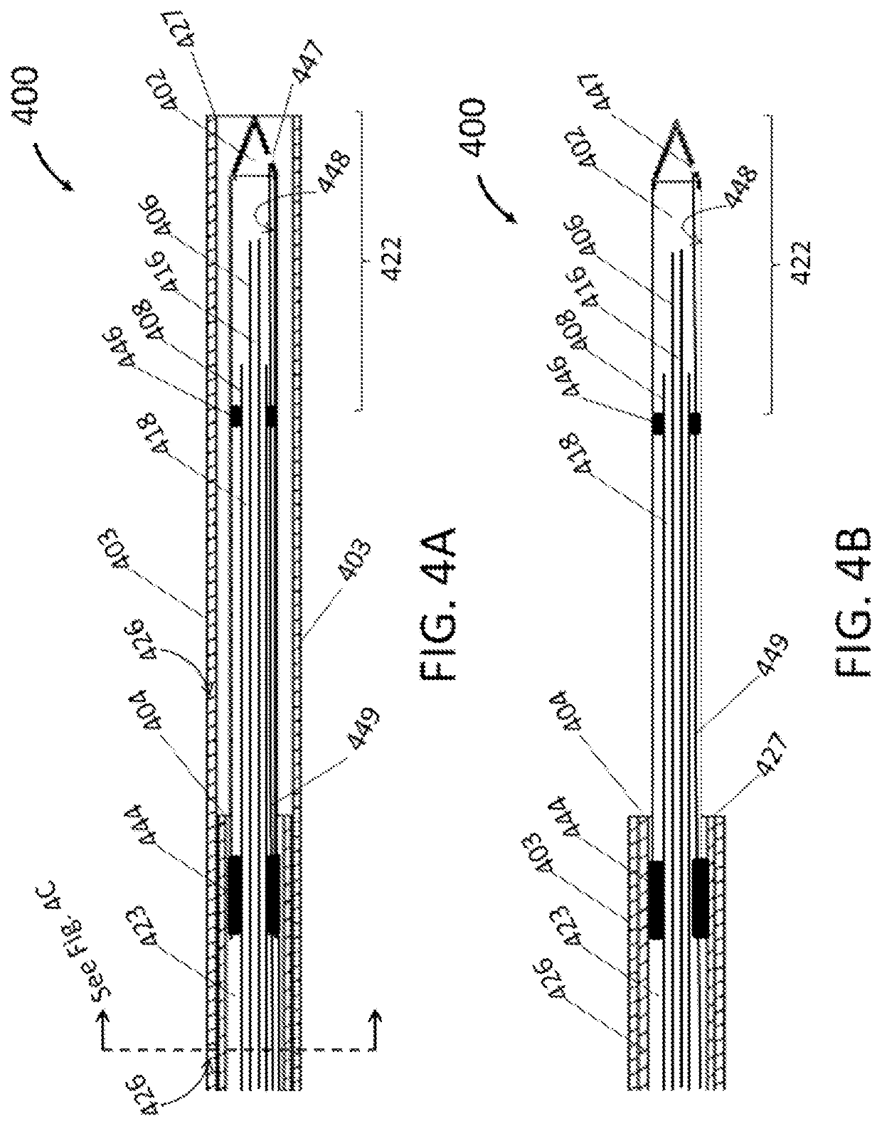 Endoscopic cryoablation catheter