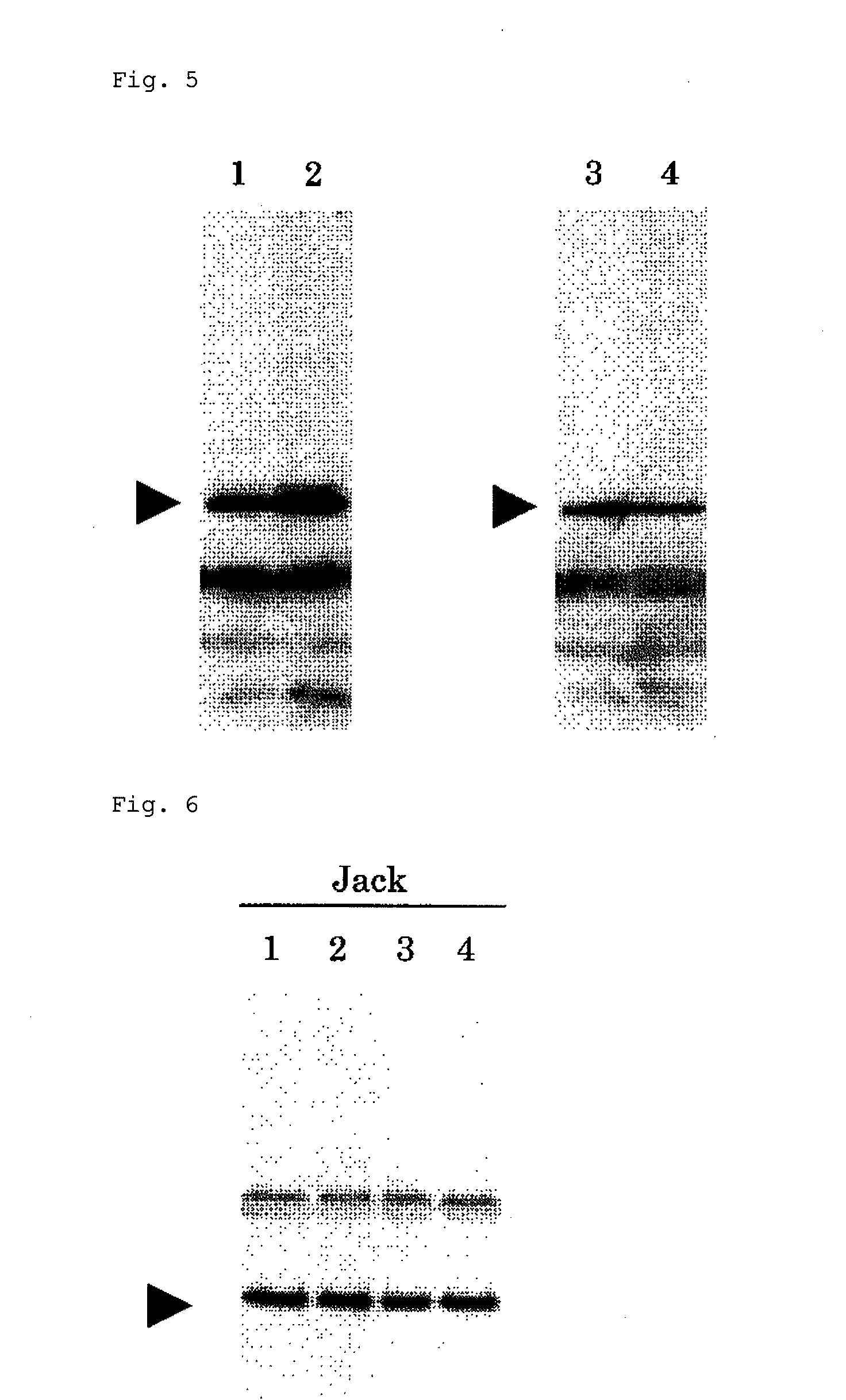 Transformed soybean plant which accumulates vaccine, and use thereof