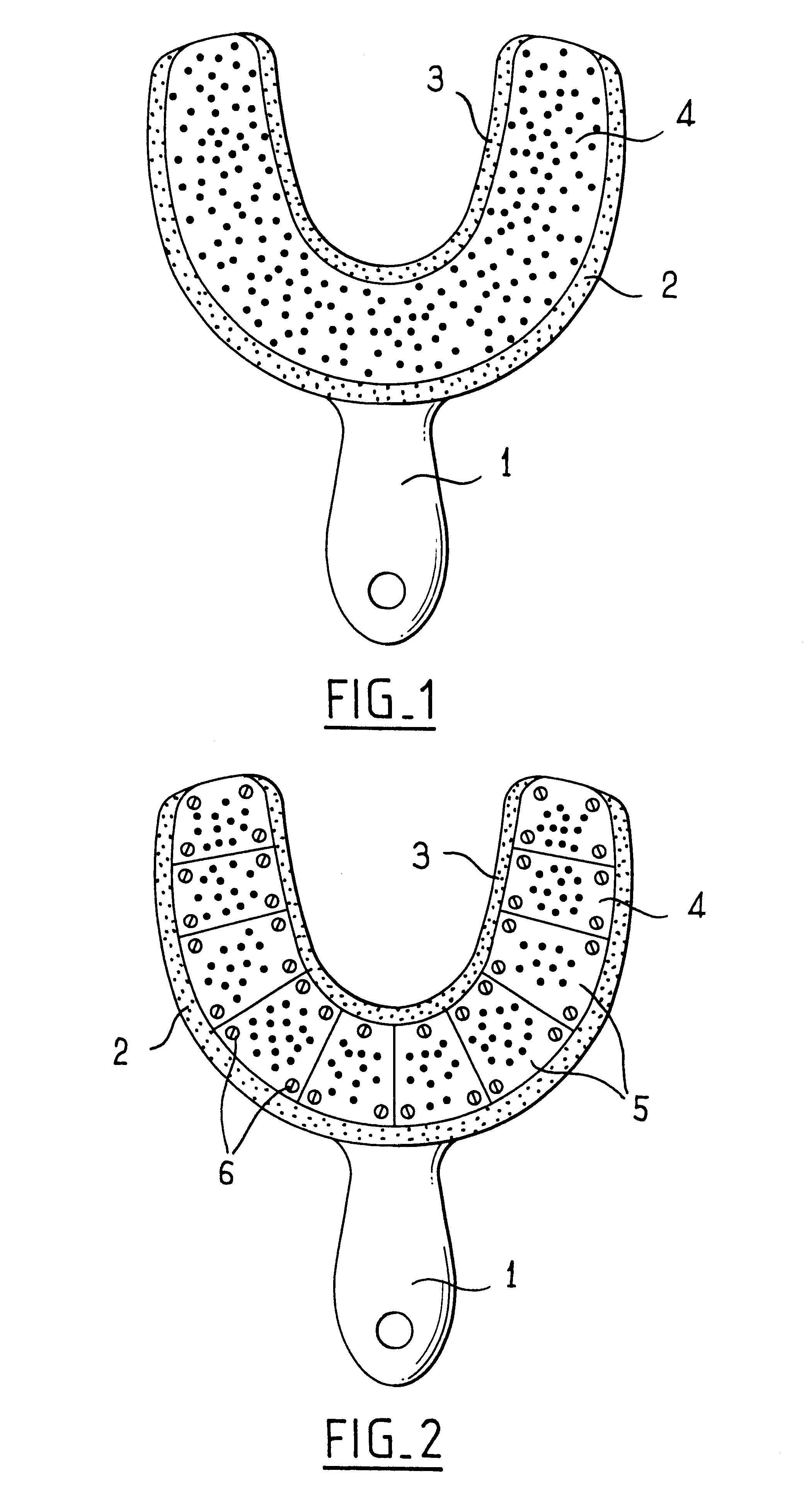 Impression tray device with removable segments for dental implant transfers