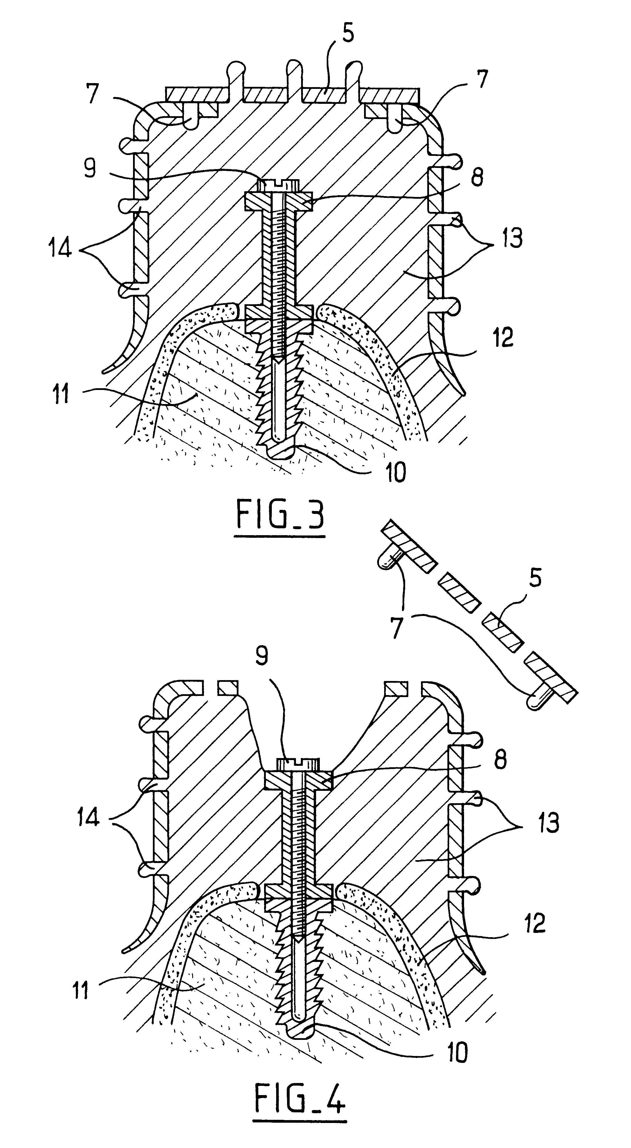 Impression tray device with removable segments for dental implant transfers