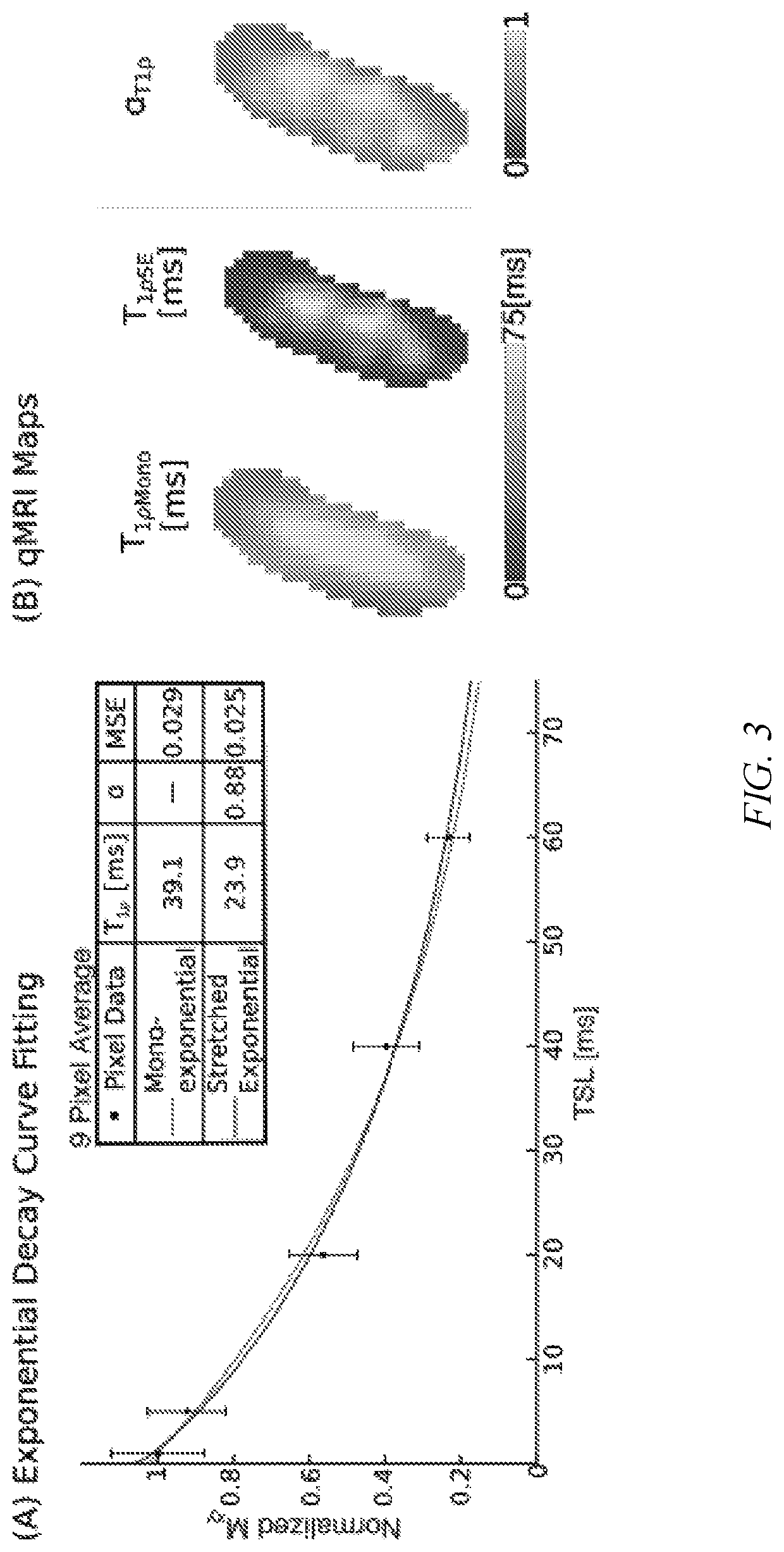 Soft tissue matrix characterization using stretched exponential relaxation modeling