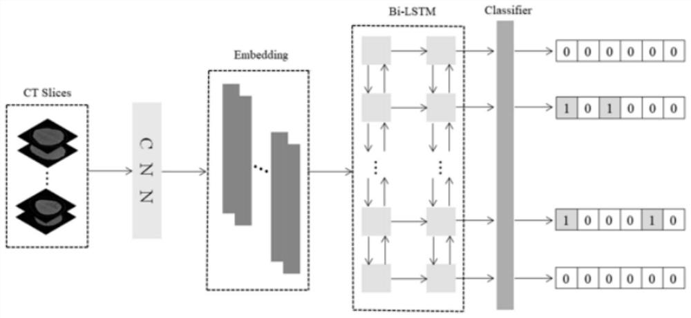 Intracranial hemorrhage subtype classification algorithm based on bilinear pooling applied to CT images