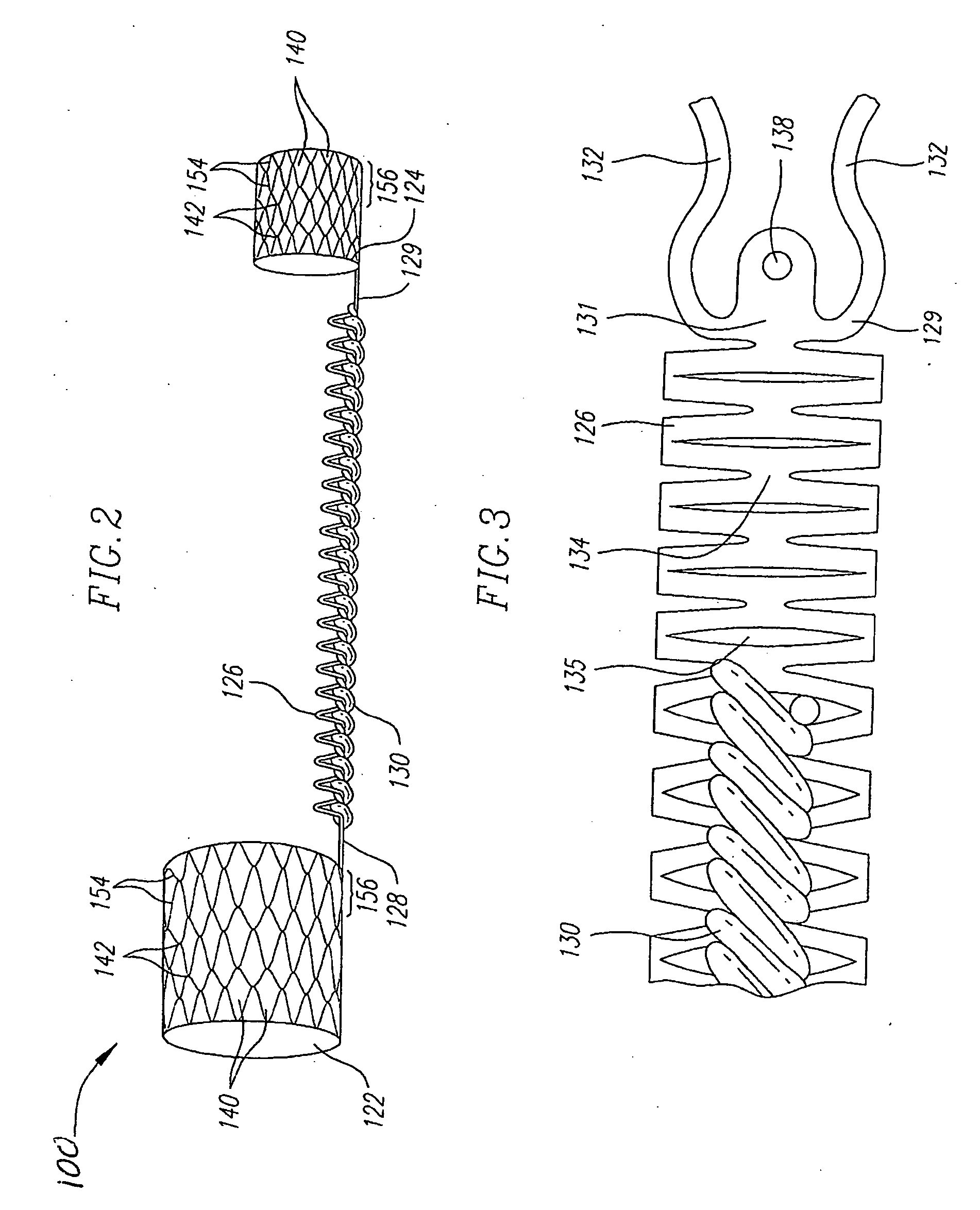 Medical implant with reinforcement mechanism