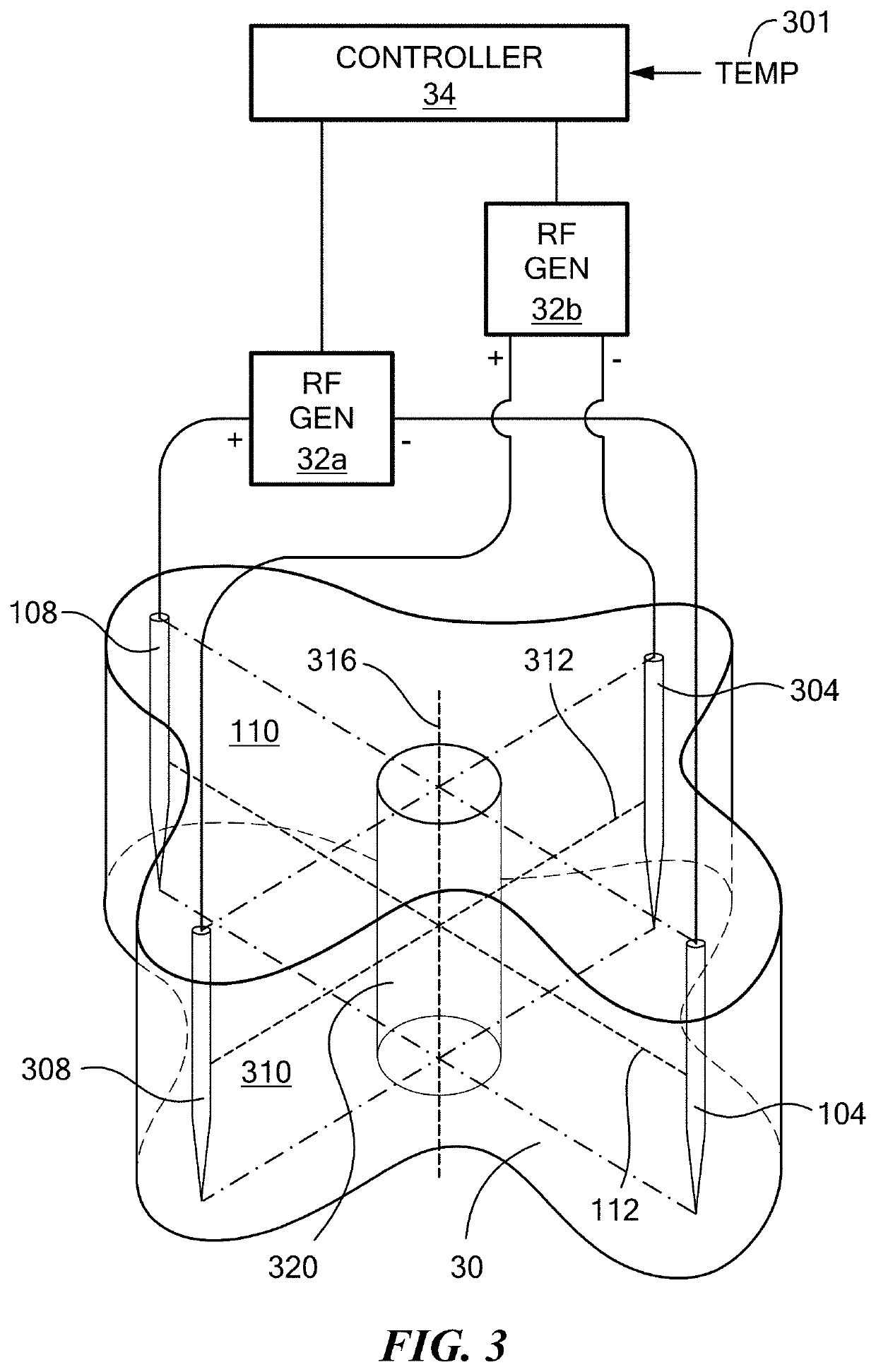 Device and method for treating tissue