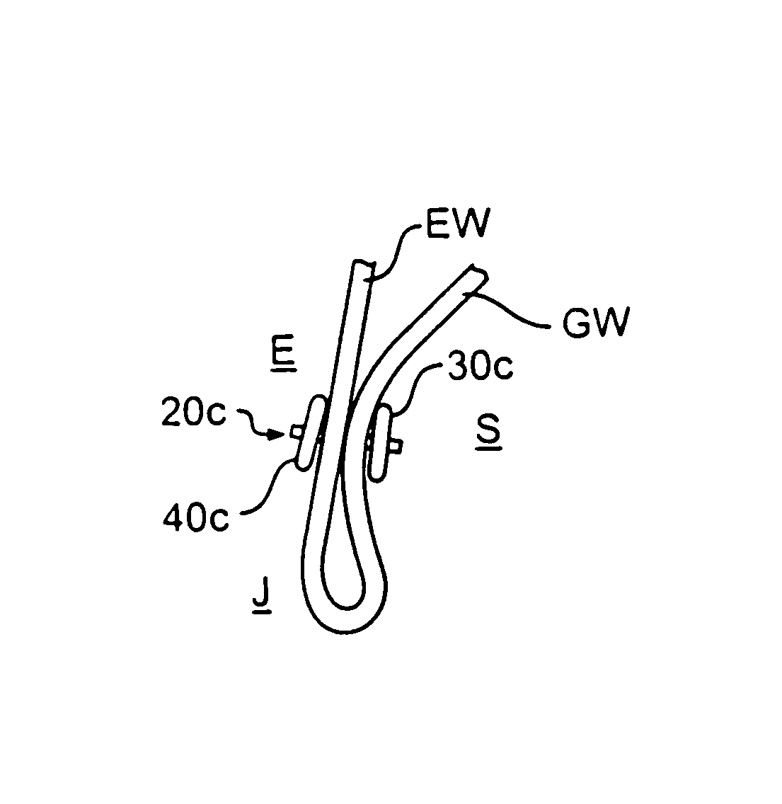 Implantable tissue fastener and system for treating gastroesophageal reflux disease
