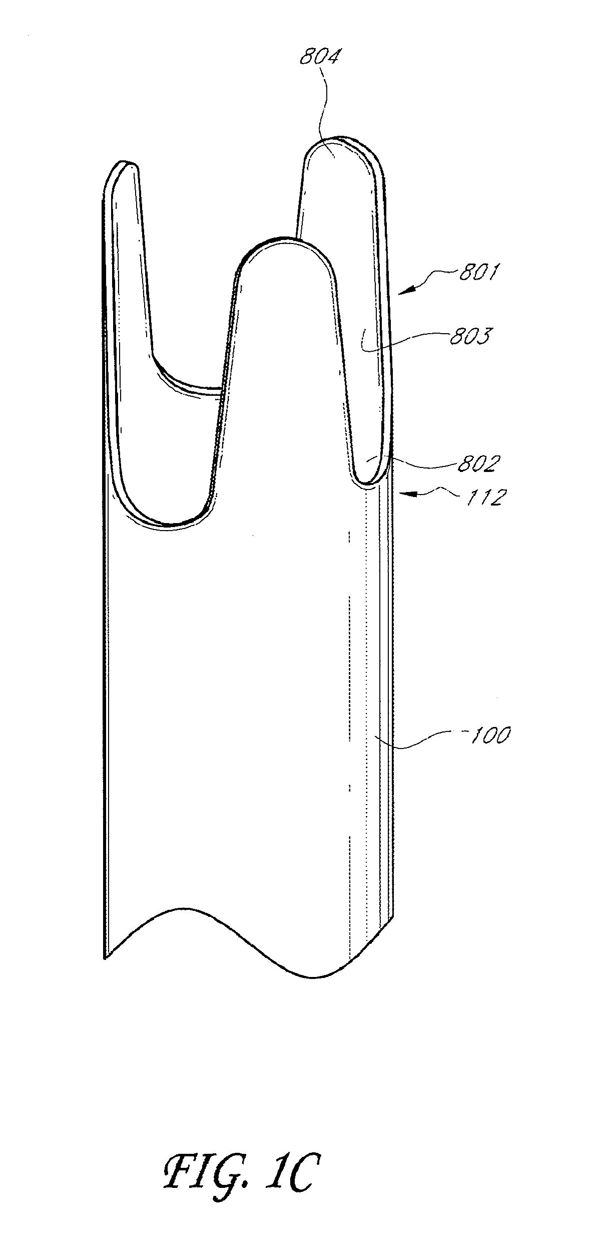 Methods for toposcopic sleeve delivery