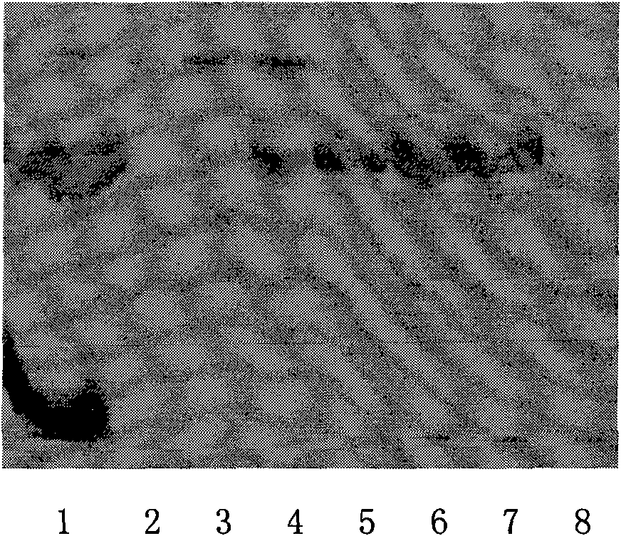 Polyethylene glycol modified human interleukin-2, preparation method and application thereof