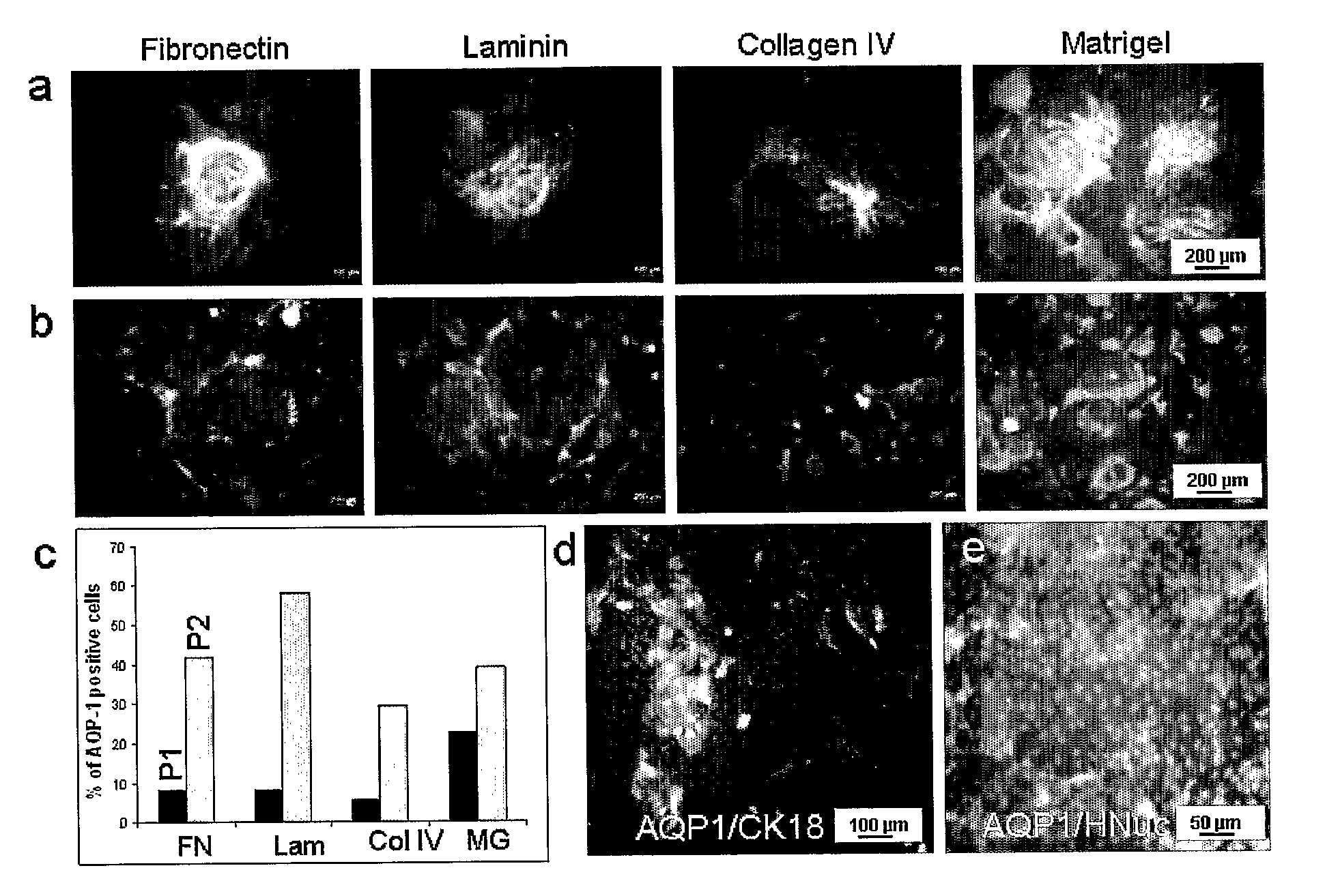 Method for differentiating embryonic stem cells into cells expressing aqp-1