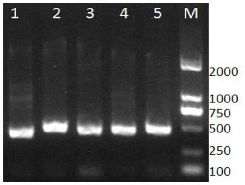 Primers and method for detecting gene mutation of JAK3 gene intron 2