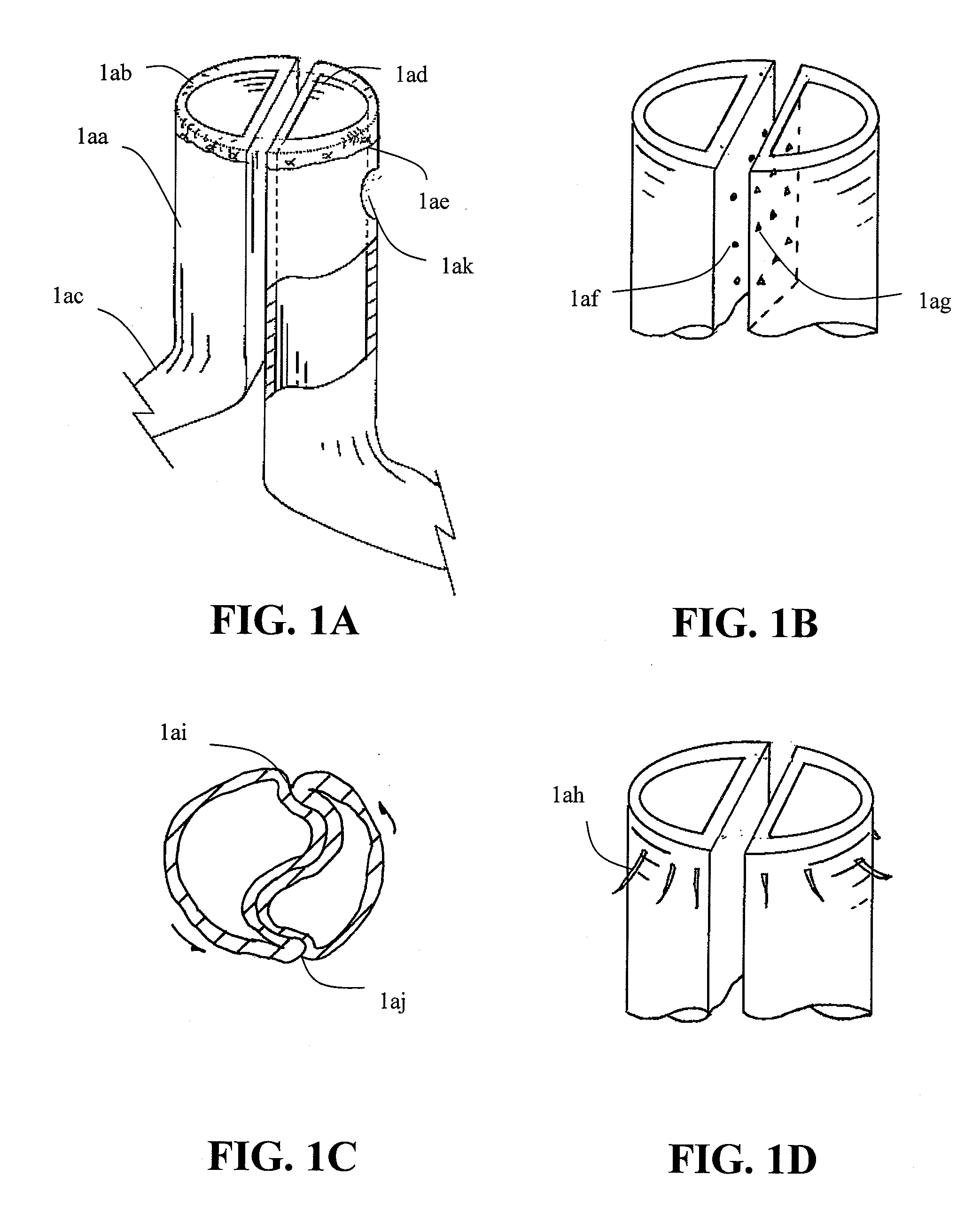 Devices and methods for treatment of abdominal aortic aneurysms