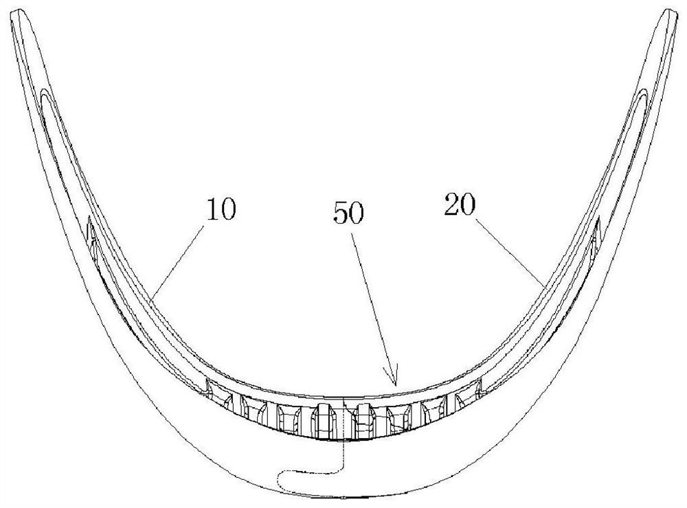 Chin implant with split embedded structure