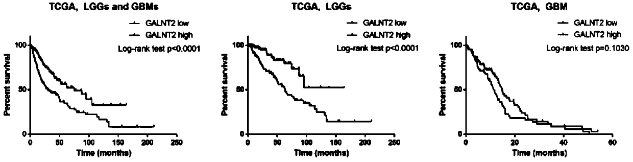 Use of galnt2 as a biomarker in the diagnosis and/or treatment of glioma