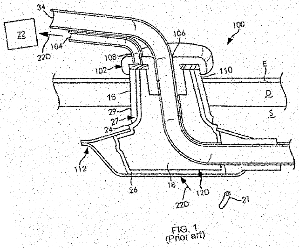 Dual lumen tubing extending from bodily inserted medical appliance and colocated infusion and vacuum pumps