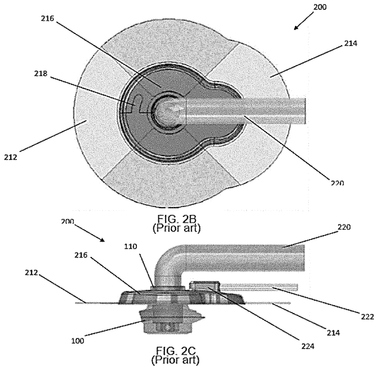 Dual lumen tubing extending from bodily inserted medical appliance and colocated infusion and vacuum pumps