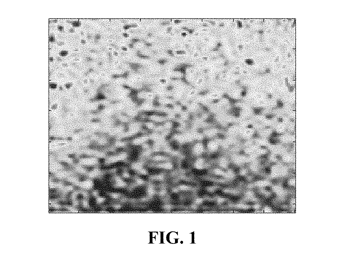 Speckle reduction instrument