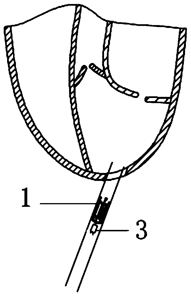 Ventricular assist device and application method