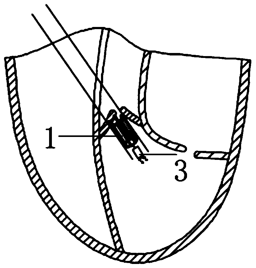 Ventricular assist device and application method