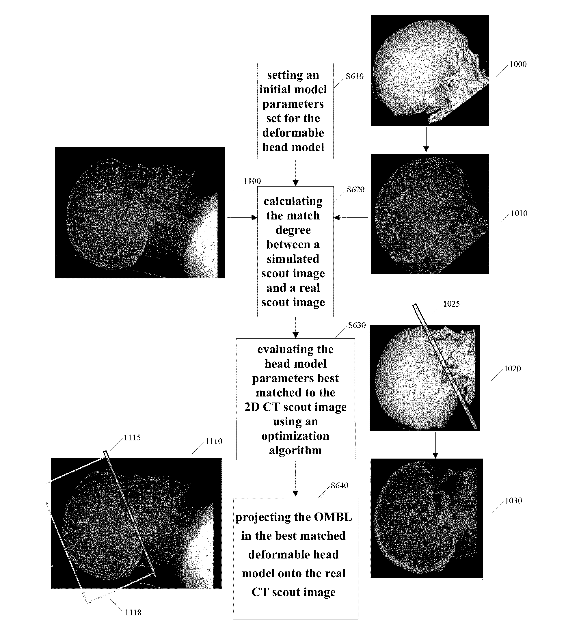 Method and system for automatically determining a localizer in a scout image