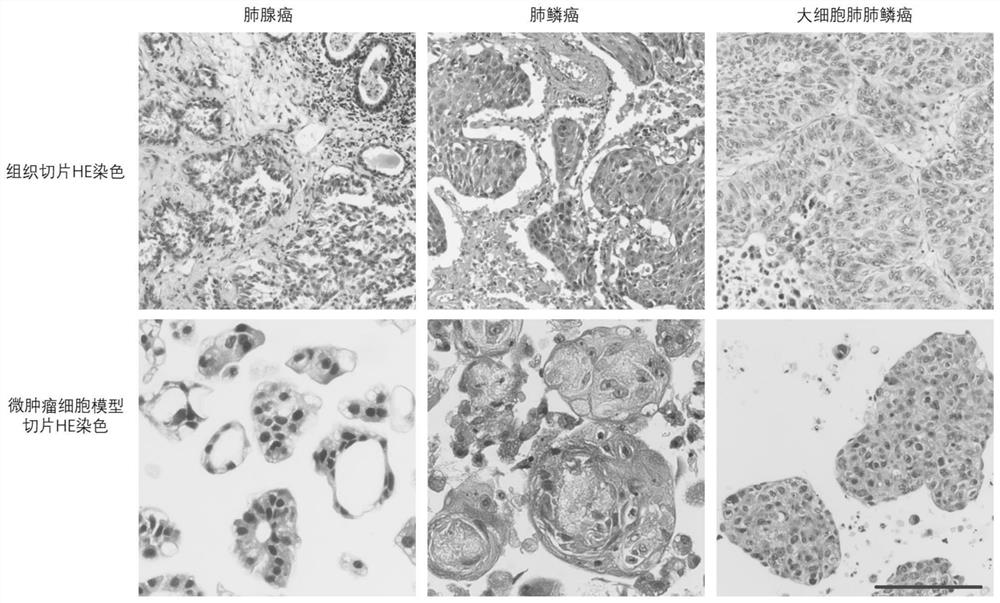 Lung cancer micro-tumor cell model culture method