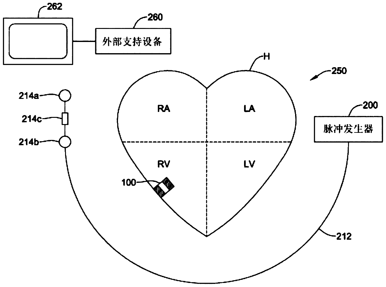 Methods and systems for detecting atrial contraction timing fiducials during ventricular filling from a ventricularly implanted leadless cardiac pacemaker