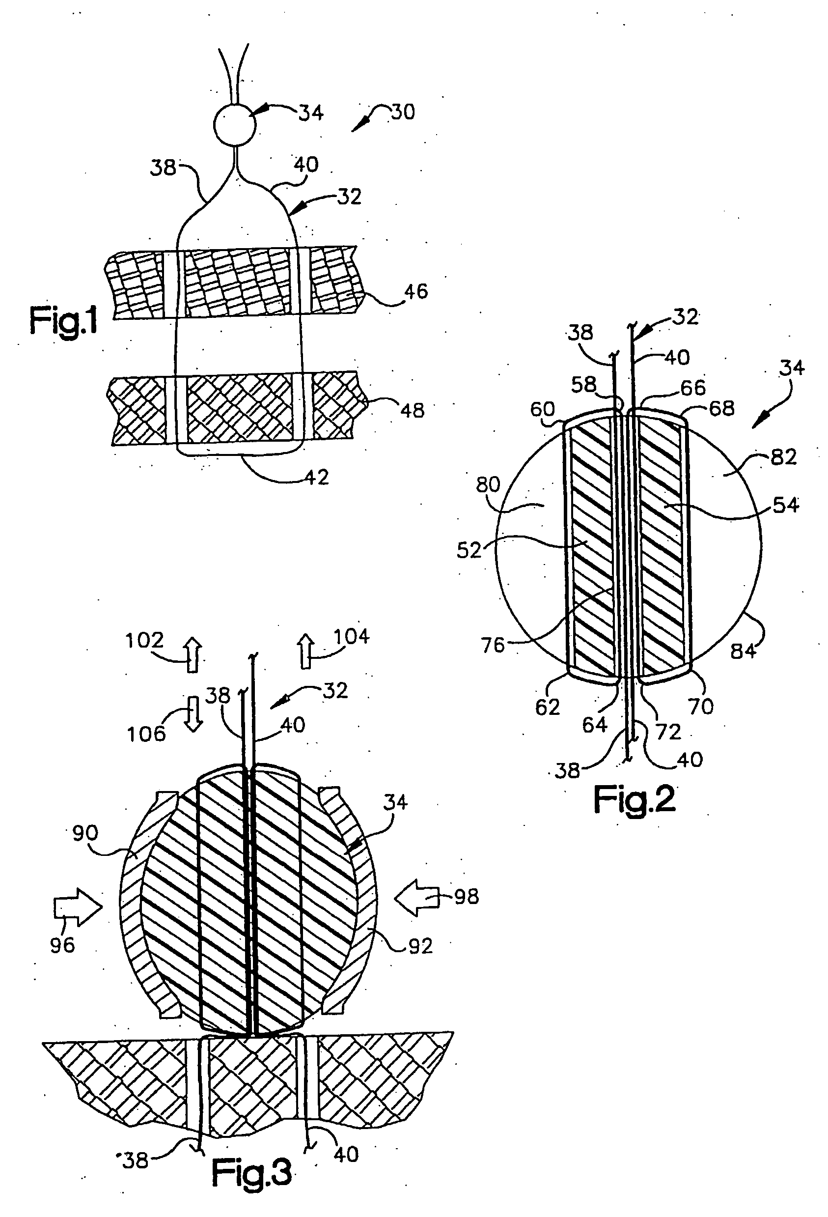 Method of using ultrasonic vibration to secure body tissue