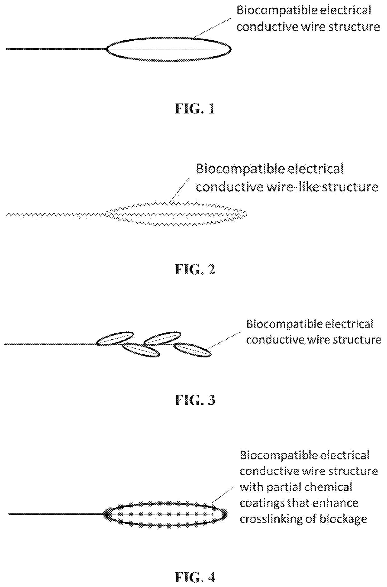 Radio frequency electro-thrombectomy device