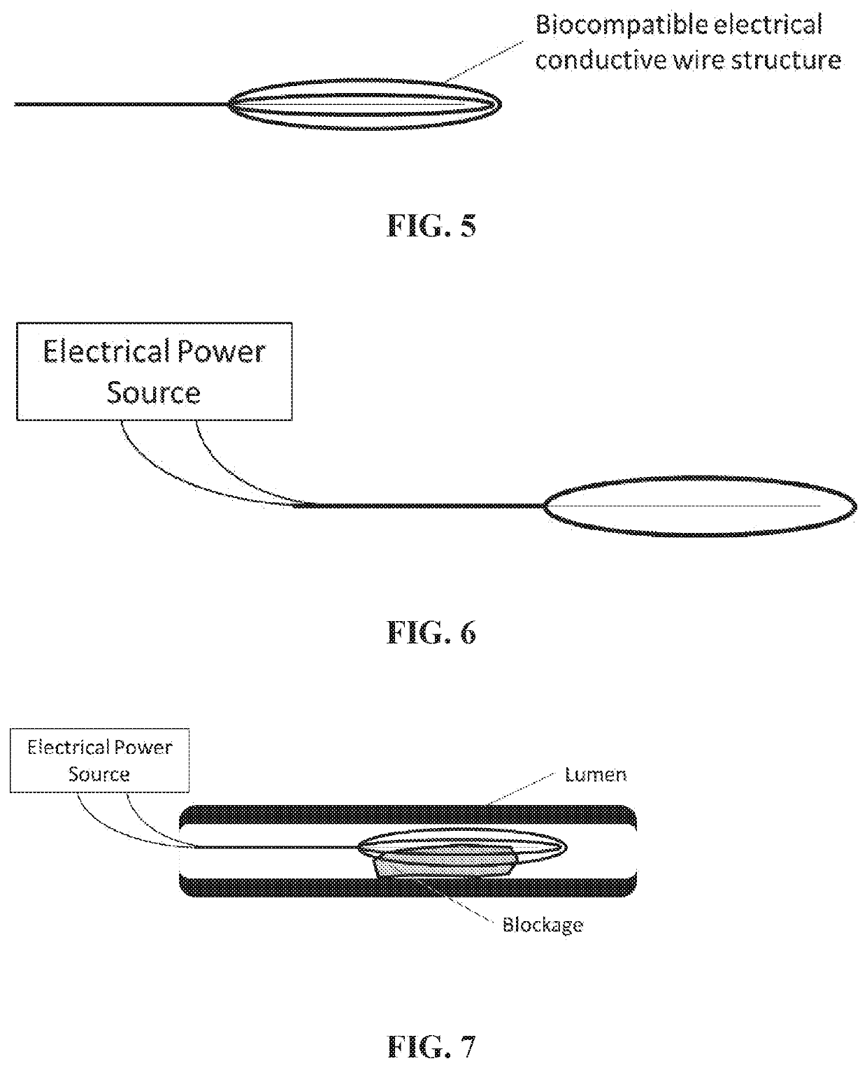 Radio frequency electro-thrombectomy device