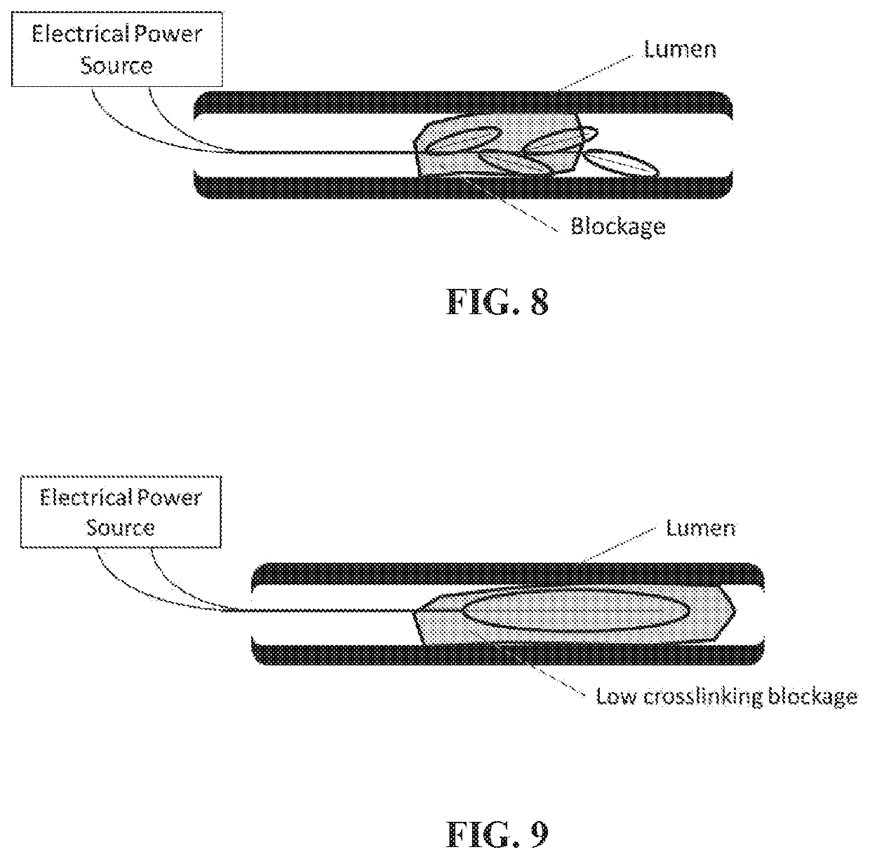 Radio frequency electro-thrombectomy device