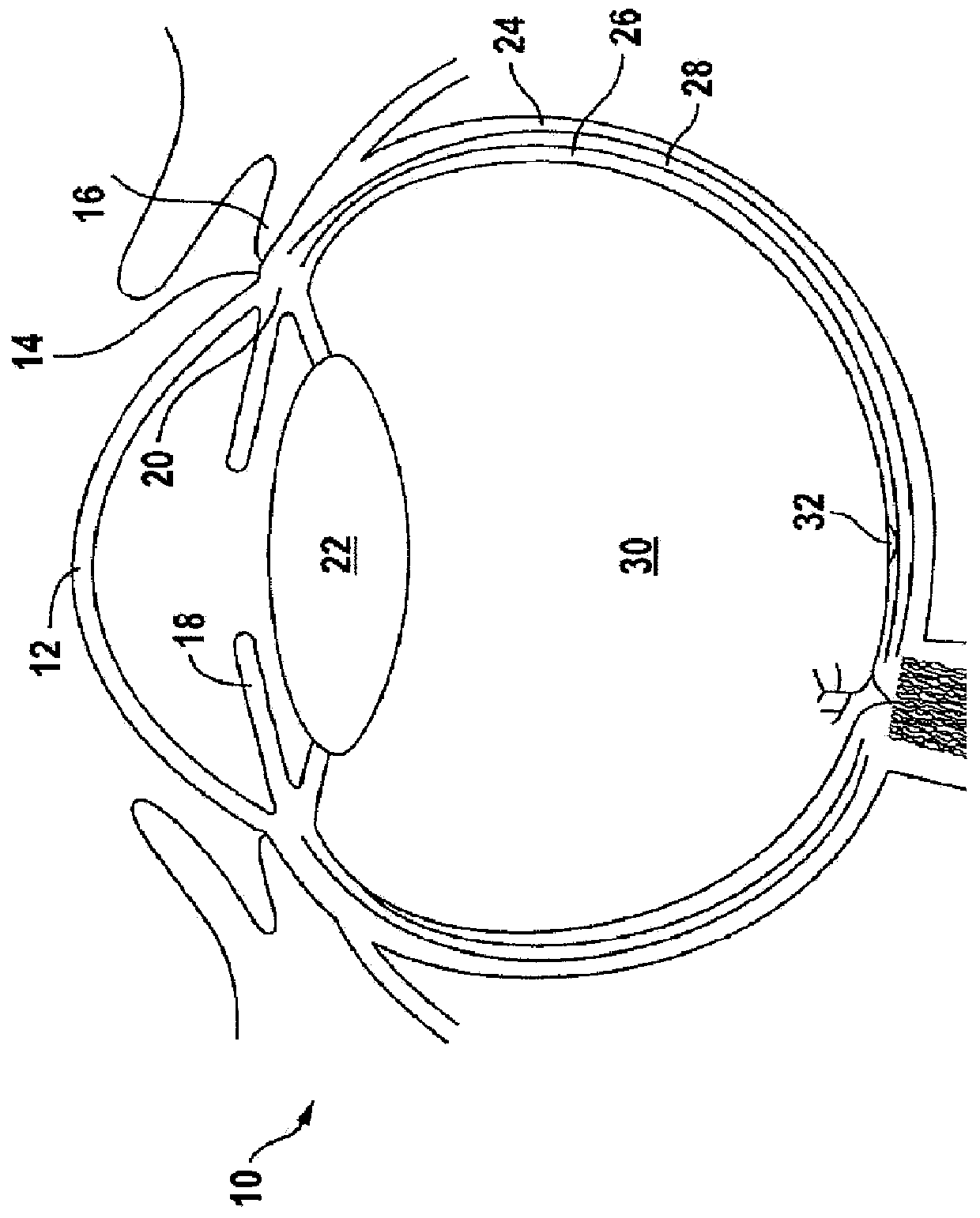 Ophthalmic implants for delivery of therapeutic substances