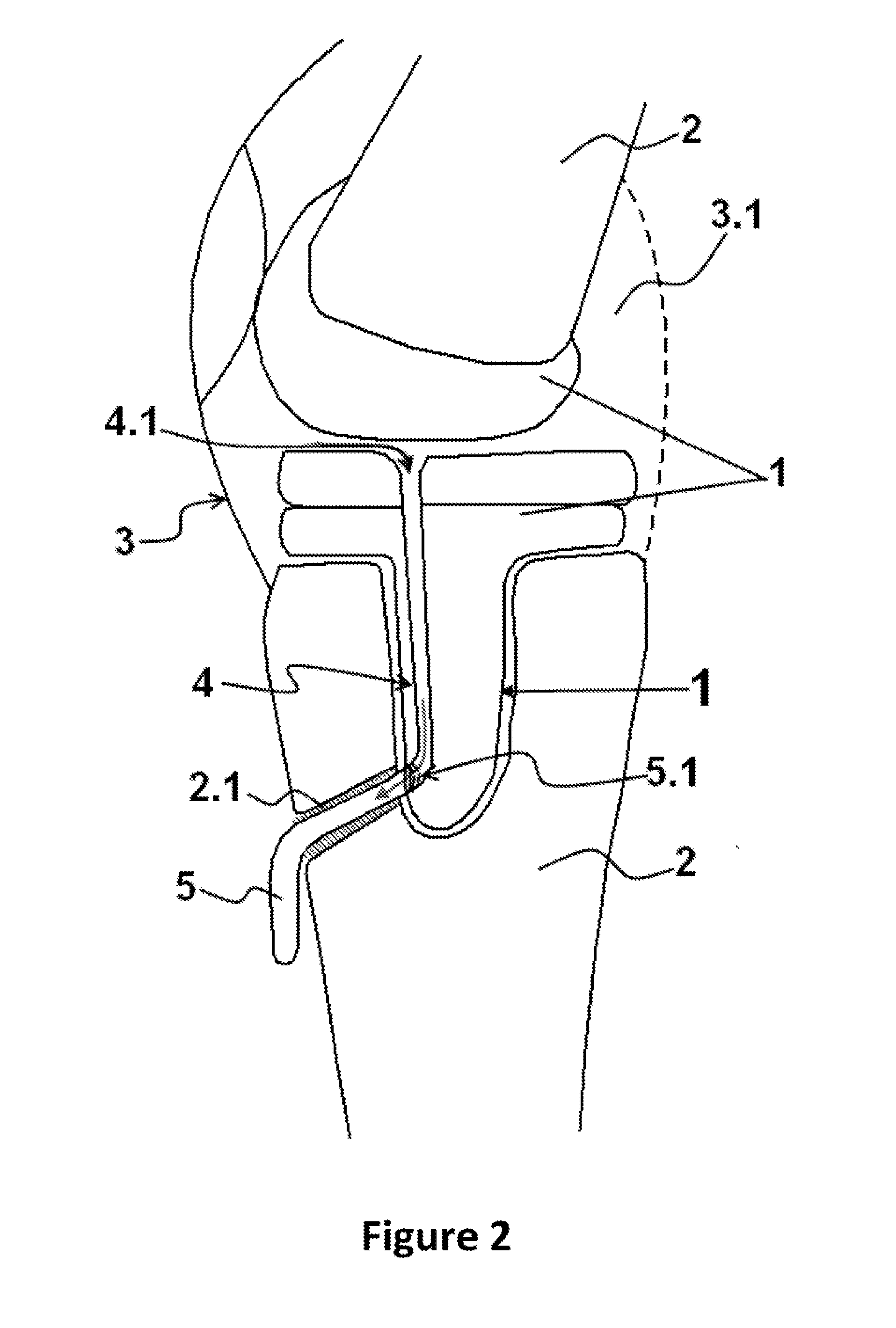 Joint fluid drainage system for the problem of aseptic loosening in the total joint prostheses